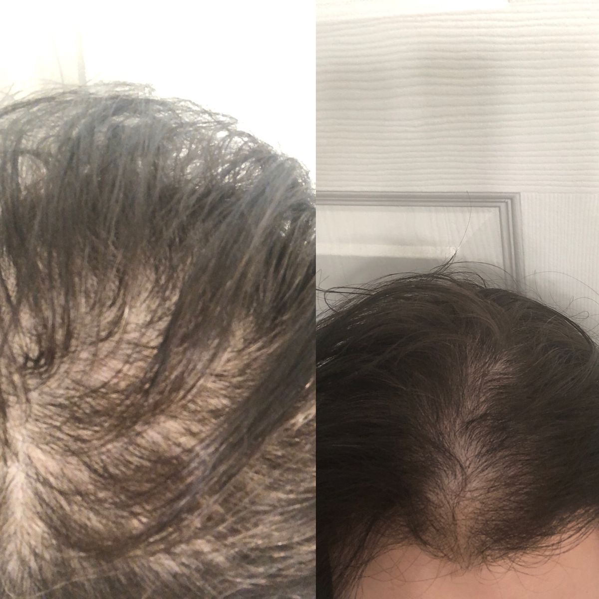6 IN 1 High Frequency Hair Wand™